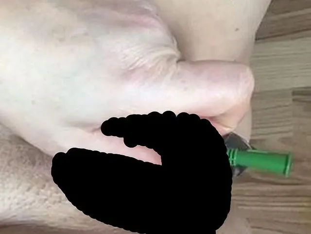 Katheter bin geil
