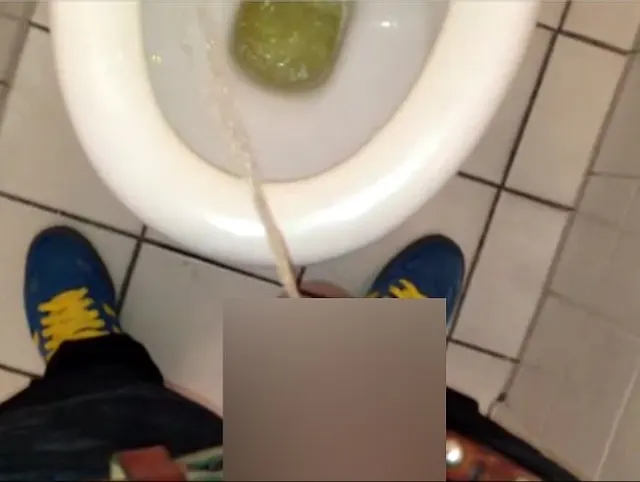 Pissen beim Zahnarzt