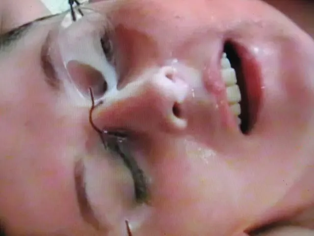 AUF DIE BRILLE GESPRITZT