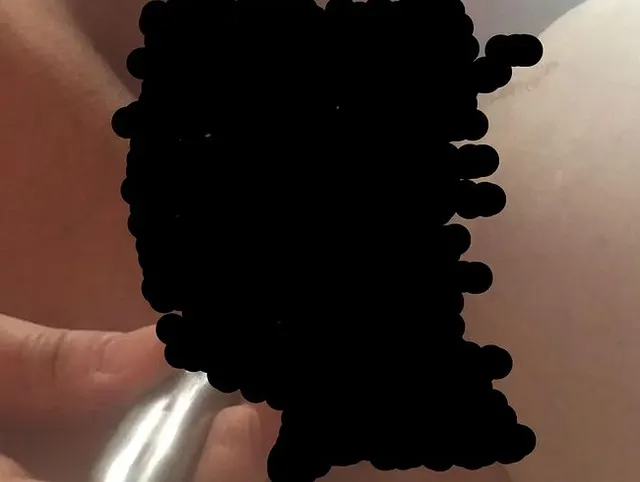 Das Spiel mit dem Dilator