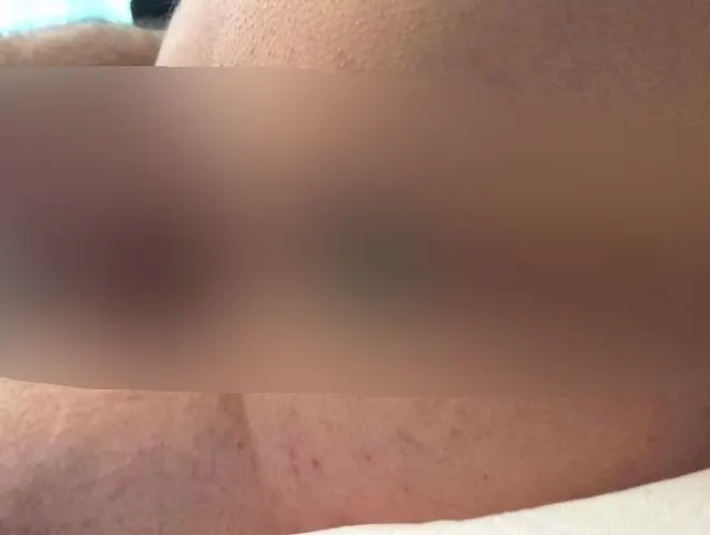 Teaser Analplug Video