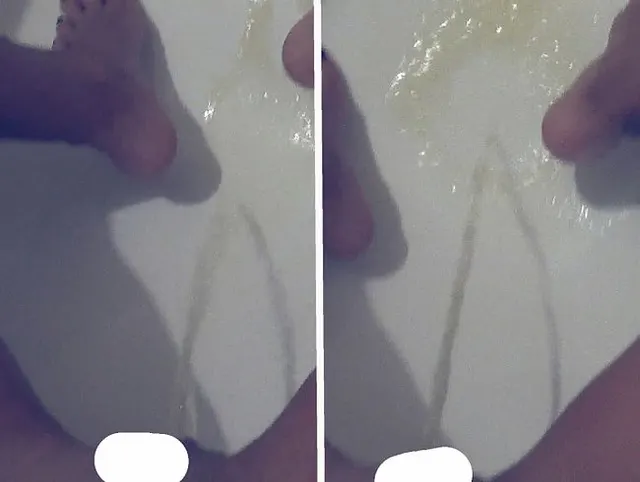 my smelly urine