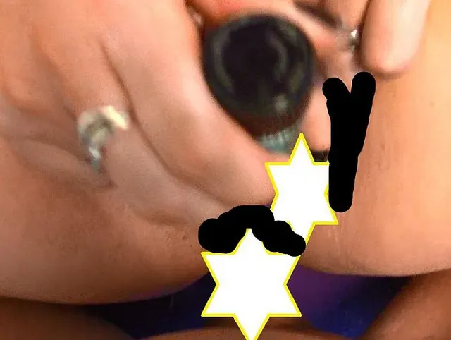 Analbefüllung