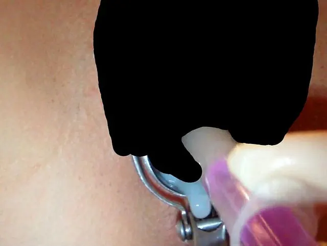 Künstliche Befruchtung
