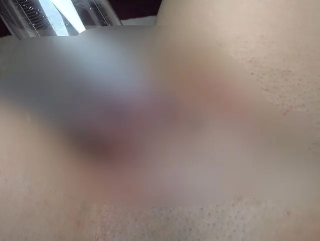 Aufgepumpte Muschi - Mein erster Versuch