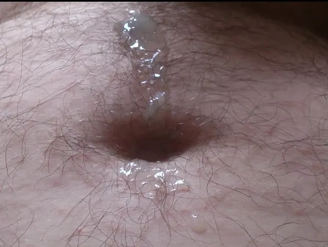 Abspritzen