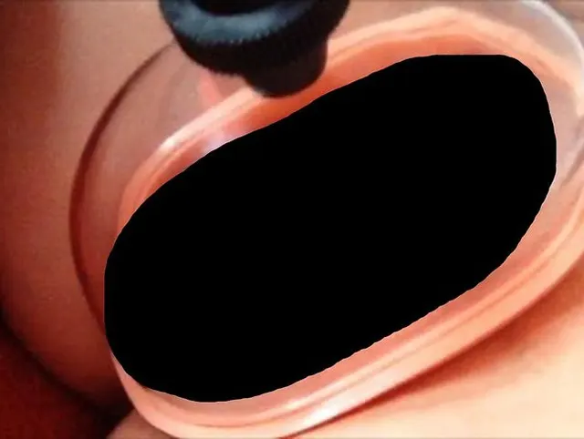Saugnapf grins