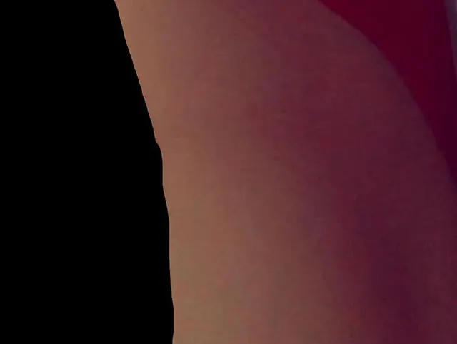 Anal- BM76